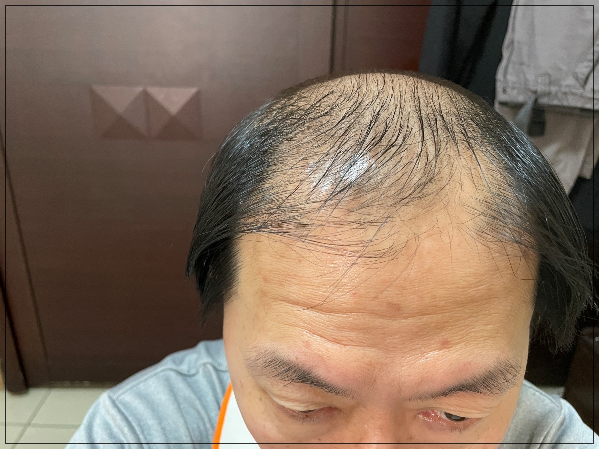 速乾、擦完像是沒擦一樣|免沖洗植物養髮液推薦|雍大生技|神秘法的森 - 第6張圖