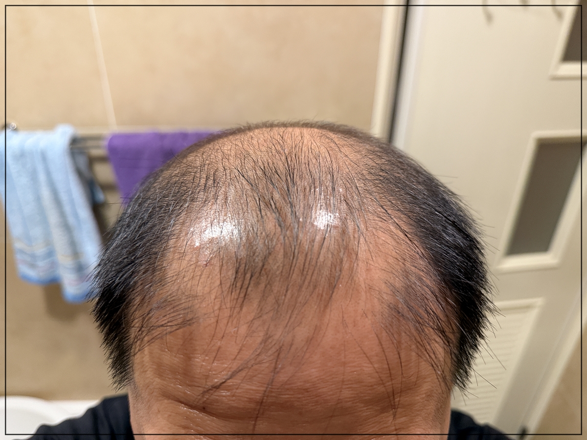 速乾、擦完像是沒擦一樣|免沖洗植物養髮液推薦|雍大生技|神秘法的森 - 第7張圖