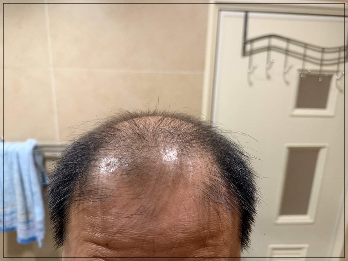 速乾、擦完像是沒擦一樣|免沖洗植物養髮液推薦|雍大生技|神秘法的森 - 第8張圖