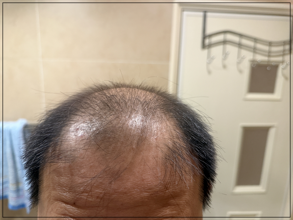 速乾、擦完像是沒擦一樣|免沖洗植物養髮液推薦|雍大生技|神秘法的森 - 第9張圖